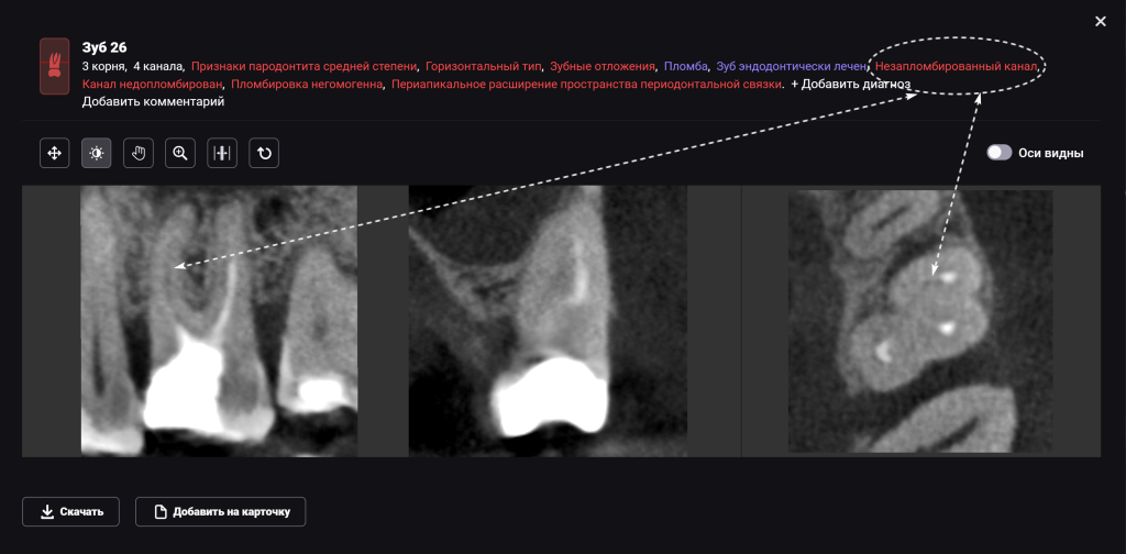 Изучите морфологию и анатомию корневых каналов с помощью Diagnocat 5