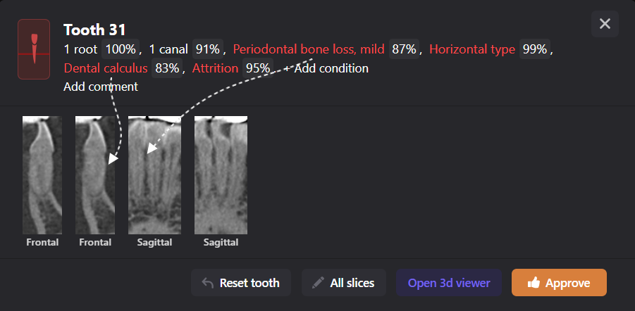 Periodontal disease srceening 7